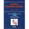 Biopsia endomiocardica