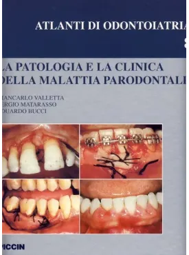 La patologia e la clinica della malattia parodontale
