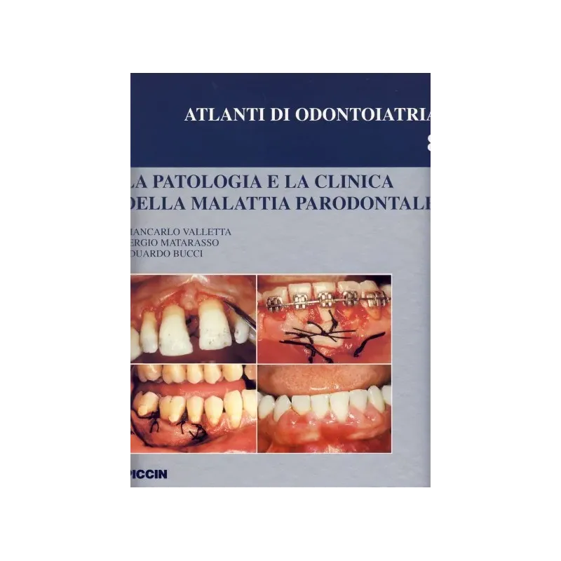 La patologia e la clinica della malattia parodontale