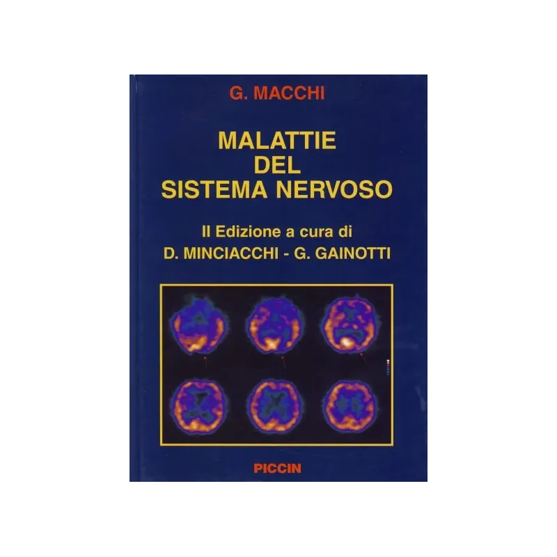 Malattie del Sistema Nervoso