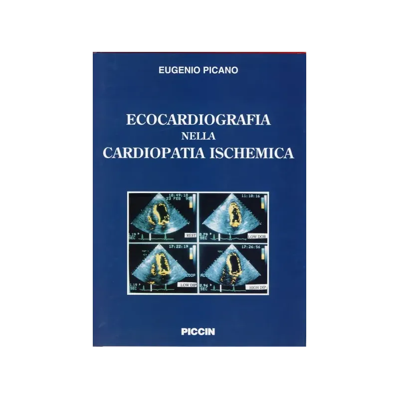 Ecocardiografia nella cardiopatia ischemica