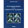 Ecocardiografia nella cardiopatia ischemica