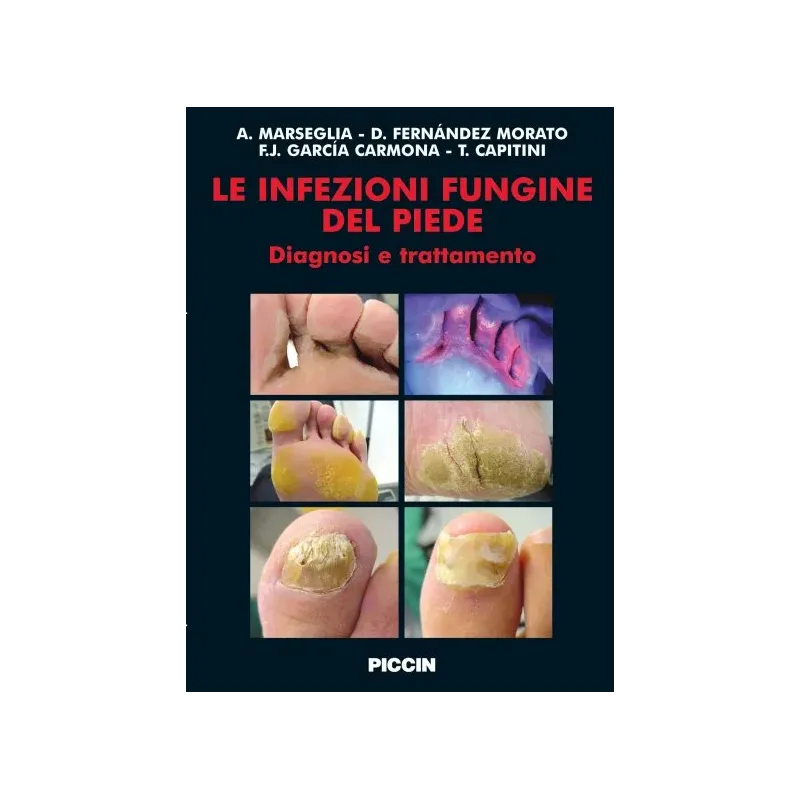 Le Infezioni Fungine del Piede