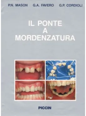 Il ponte a mordenzatura