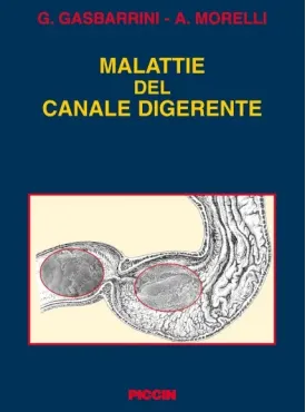 Malattie del canale digerente