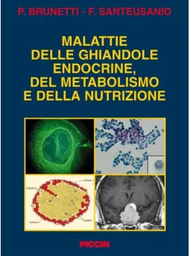 Malattie delle ghiandole endocrine, del metabolismo e della nutrizione