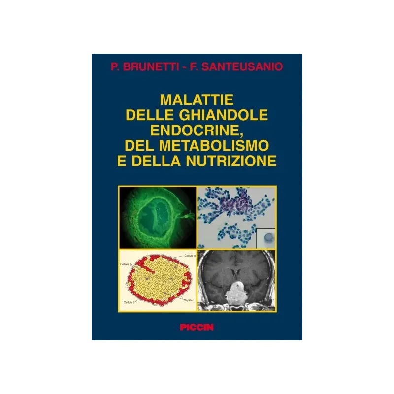 Malattie delle ghiandole endocrine, del metabolismo e della nutrizione