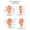 Poster a colori di agopuntura auricolare