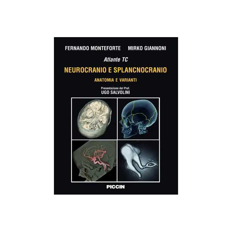 Atlante tc Neurocranio e Splancnocranio