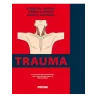 Trauma