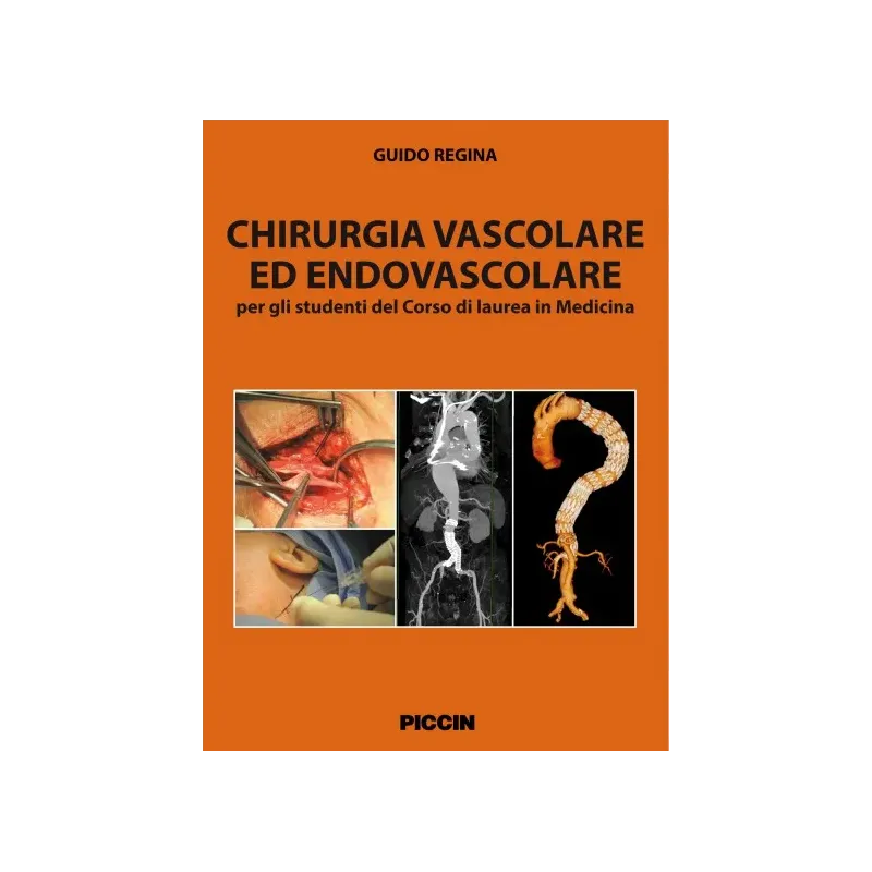 Chirurgia vascolare ed endovascolare