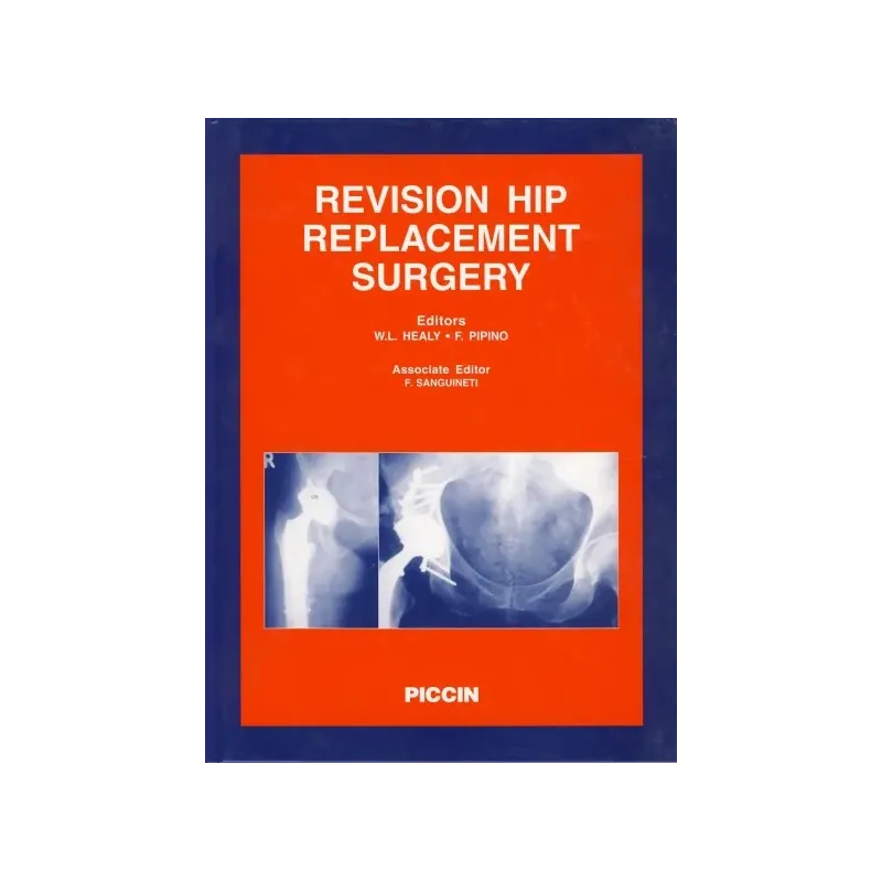 REVISION HIP REPLACEMENT SURGERY