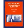 REVISION HIP REPLACEMENT SURGERY