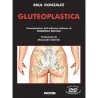 Gluteoplastica