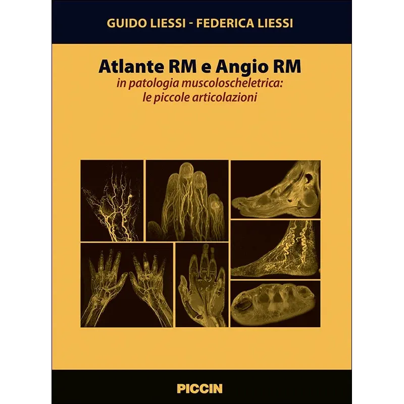 Atlante Rm e Angio Rm in patologia muscoloscheletrica: le piccole articolazioni