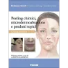 Peeling chimici, microdermoabrasione e prodotti topici
