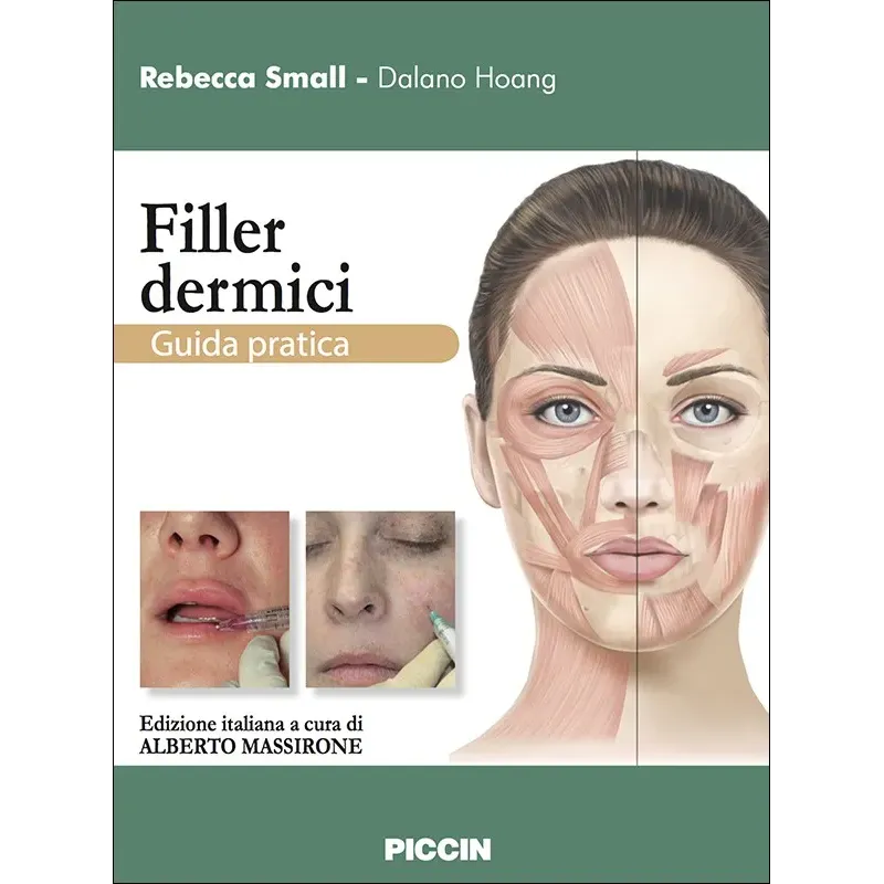 I filler - Guida pratica
