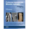 Colonna Vertebrale Midollo Spinale - Imaging