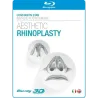 Aesthetic Rhinoplasty