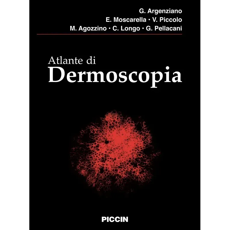 Atlante di Dermoscopia