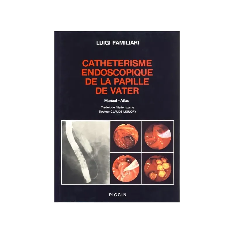 CATHETERISME ENDOSCOPIQUE DE LA PAPILLE DE VATER