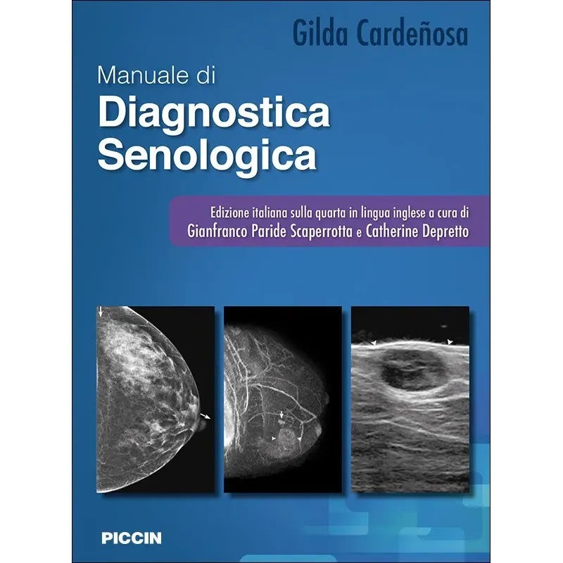 Imaging della mammella