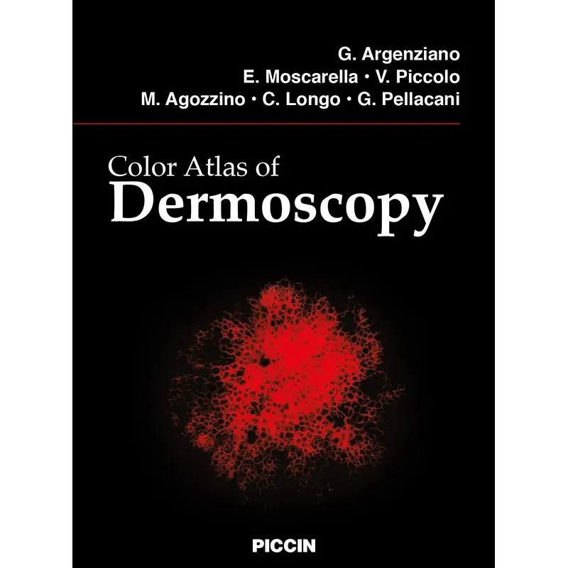 Color Atlas of Dermoscopy