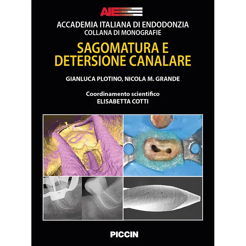 SAGOMATURA E DETERSIONE CANALARE
