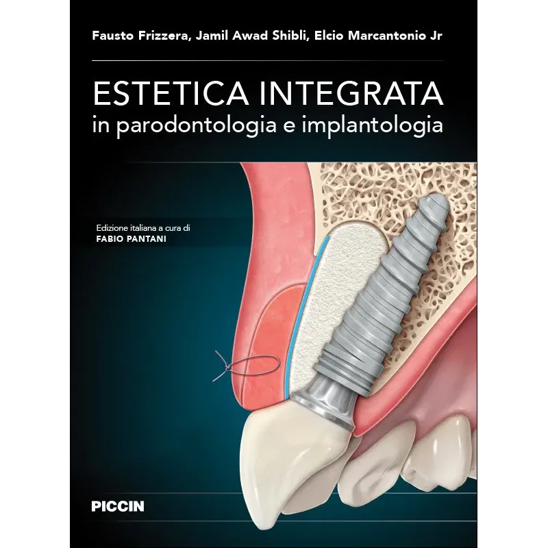 Estetica integrata in parodontologia e implantologia