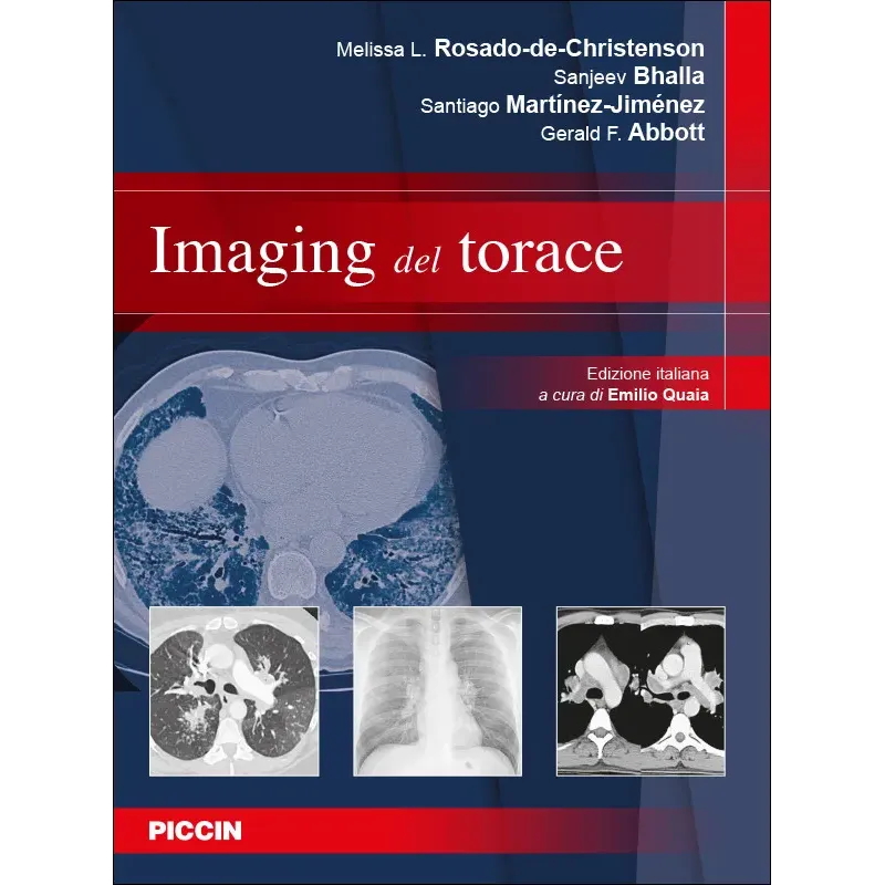 Imaging del torace