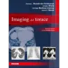 Imaging del torace