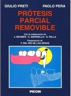 Pròtesis Parcial Removible