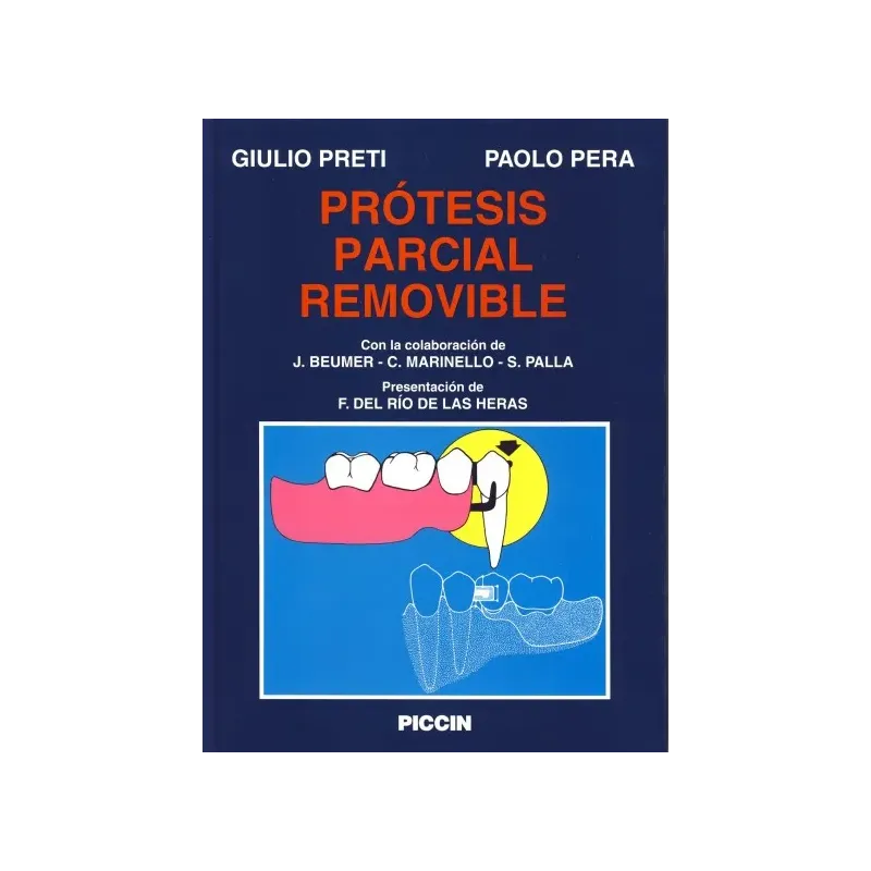 Pròtesis Parcial Removible