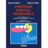 Pròtesis Parcial Removible