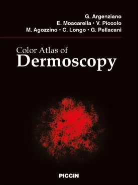 COLOR ATLAS OF DERMOSCOPY