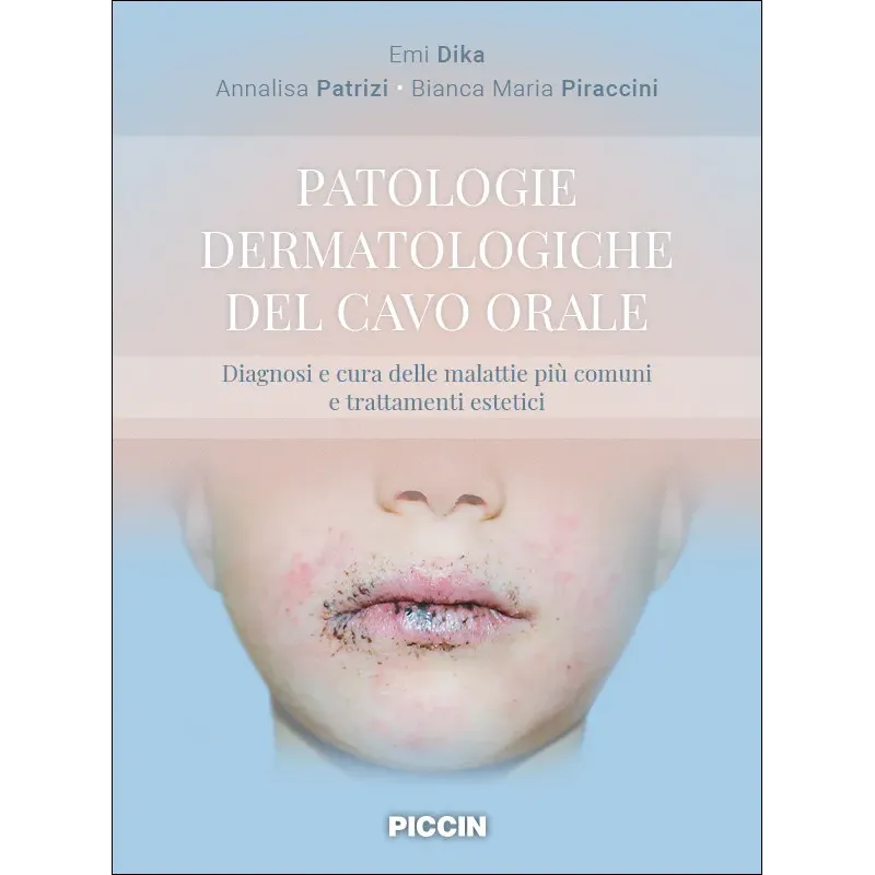 Patologie dermatologiche del cavo orale