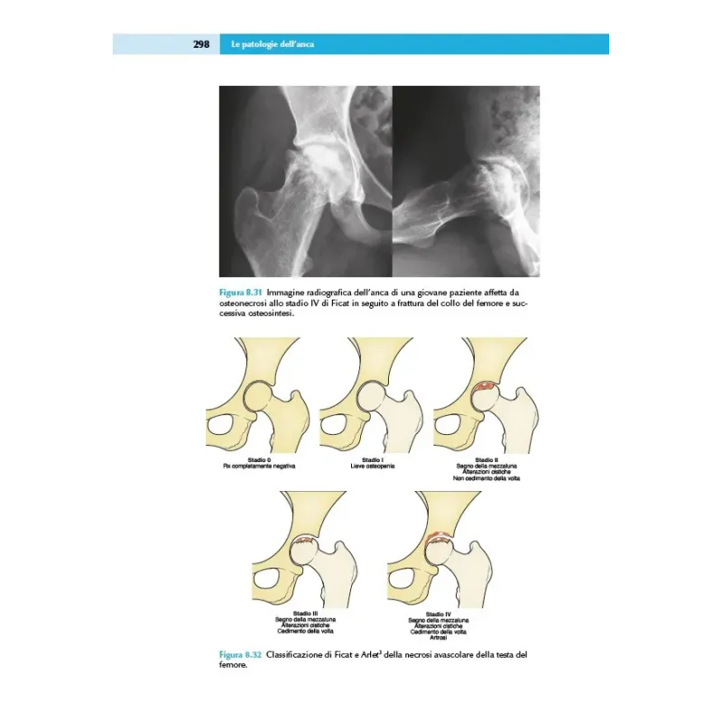 Ortopedia e Traumatologia