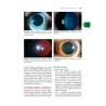 Wills Eye - Il Manuale - Diagnosi e Trattamento delle Malattie Oculari in Ambulatorio e Pronto Soccorso