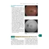 Wills Eye - Il Manuale - Diagnosi e Trattamento delle Malattie Oculari in Ambulatorio e Pronto Soccorso