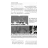 Neurochirurgia moderna