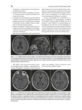 Neurochirurgia moderna