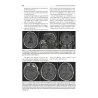 Neurochirurgia moderna