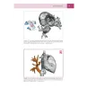 Congenital heARts - A Virtual Atlas of Congenital Heart Disease in Prenatal and Postnatal Life