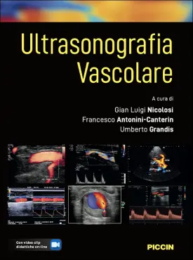 ULTRASONOGRAFIA VASCOLARE