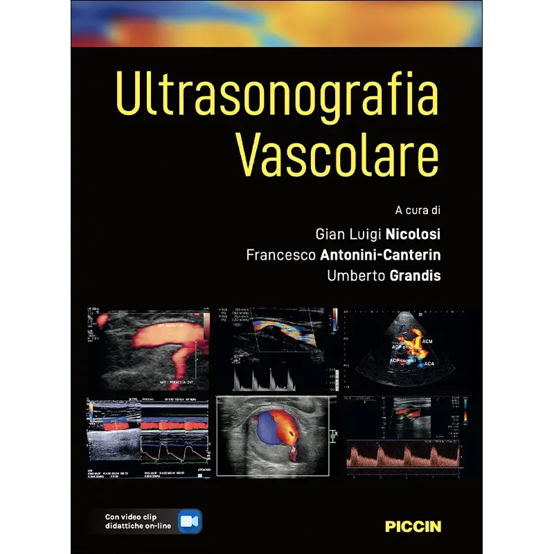 ULTRASONOGRAFIA VASCOLARE