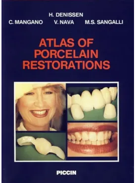 Atlas of porcelain restorations