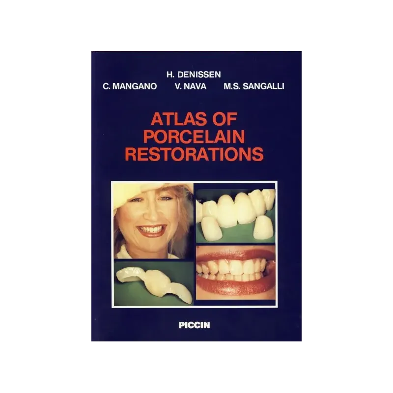 Atlas of porcelain restorations