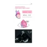 Ecocardiografia transesofagea con ECO 3D