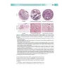 Patogenesi-Basi genetiche e molecolari delle malattie