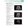 ULTRASONOGRAFIA VASCOLARE